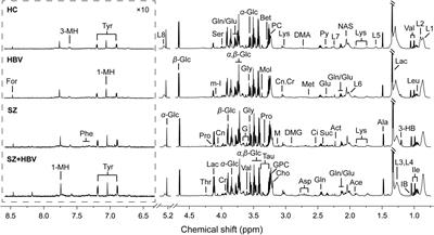 Serum metabolic signatures of schizophrenia patients complicated with hepatitis B virus infection: A 1H NMR-based metabolomics study